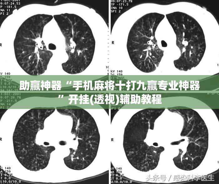 助赢神器“手机麻将十打九赢专业神器”开挂(透视)辅助教程